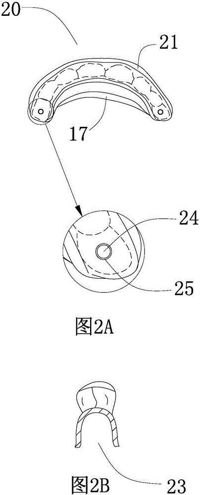 一种固定件和假牙结构的制作方法与工艺