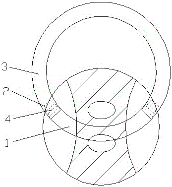 结肠双腔造瘘支撑管的制作方法与工艺