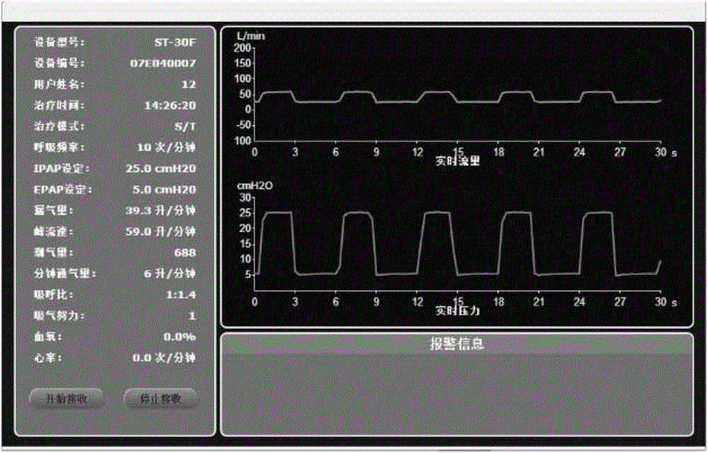 一种远程展示呼吸机实时治疗数据的波形图绘制方法与流程