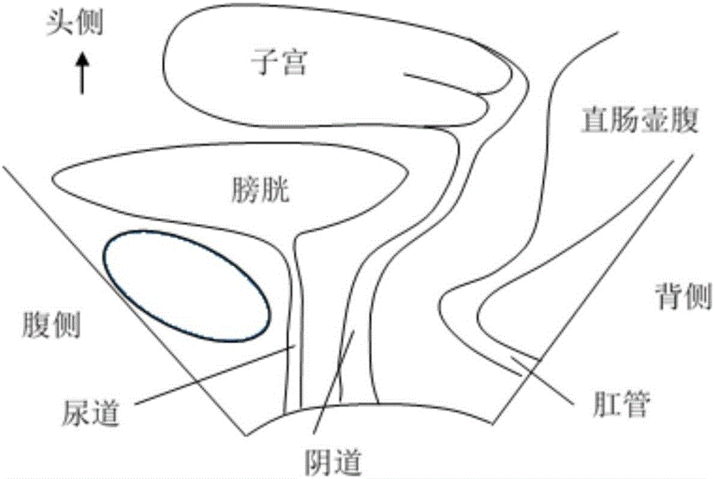 肛提肌轴平面图像处理方法及装置与流程