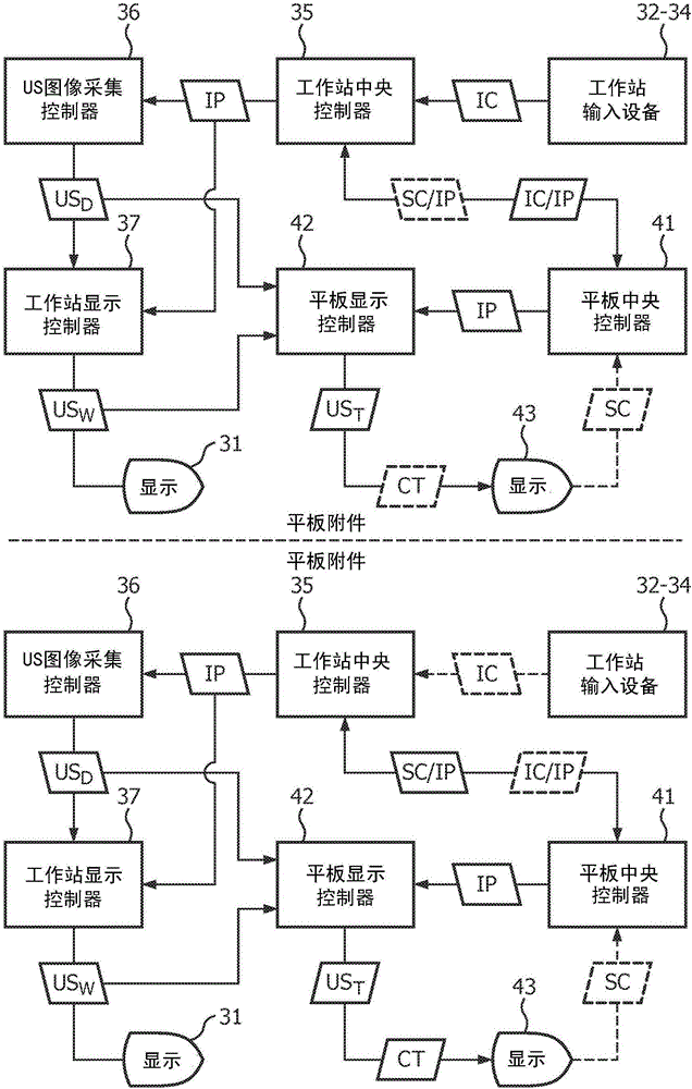 用于超聲工作站的便攜式超聲接口的制作方法與工藝