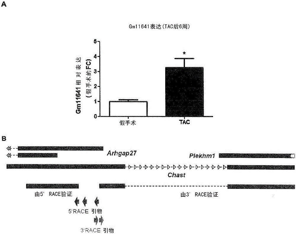 用于心臟肥大治療和診斷的LncRNA的制作方法與工藝