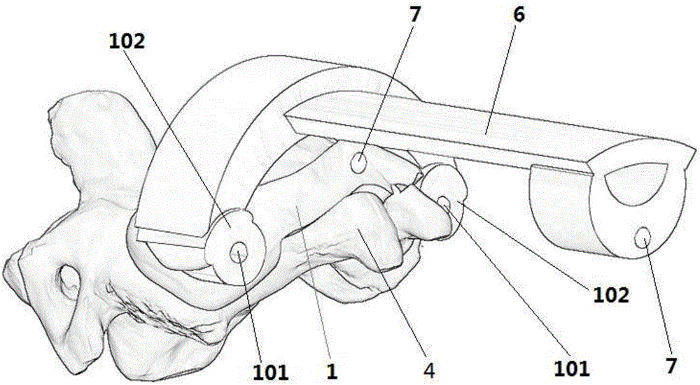 一种颈椎椎弓根螺钉进钉导向模板的制作方法与工艺