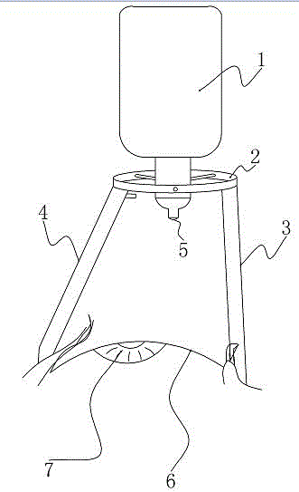 眼药滴入固定装置的制作方法
