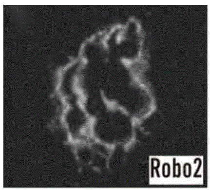 用于诊断和治疗肾脏疾病的SLIT‑ROBO信号的制造方法与工艺