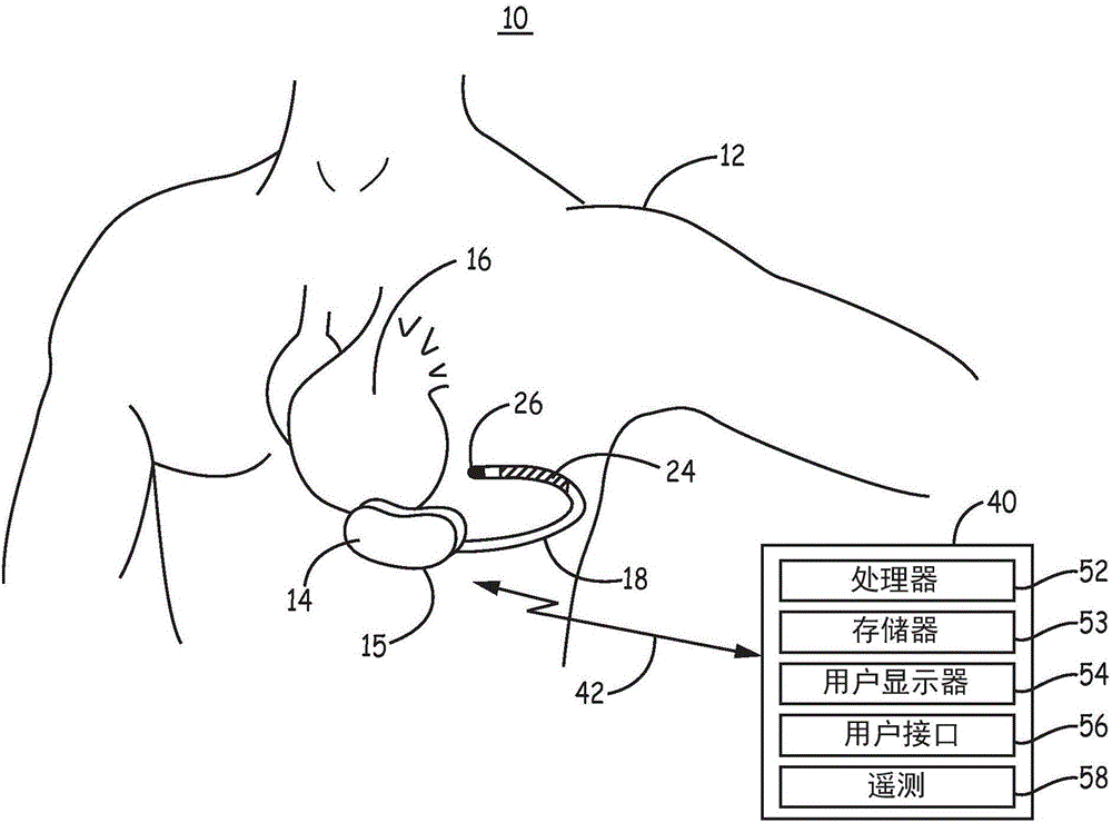 心臟信號感測測試的視覺表示的制造方法與工藝