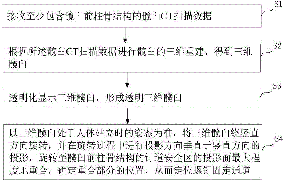 髖臼前柱順行螺釘?shù)尼數(shù)蓝ㄎ环椒跋到y(tǒng)與制造工藝