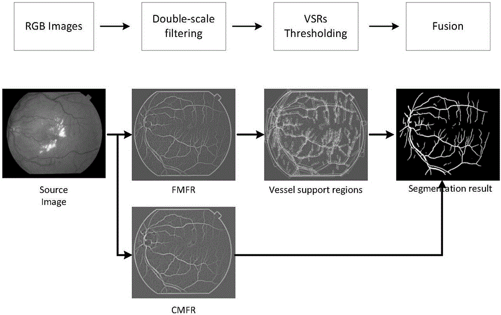 视网膜血管图像的分割方法与制造工艺