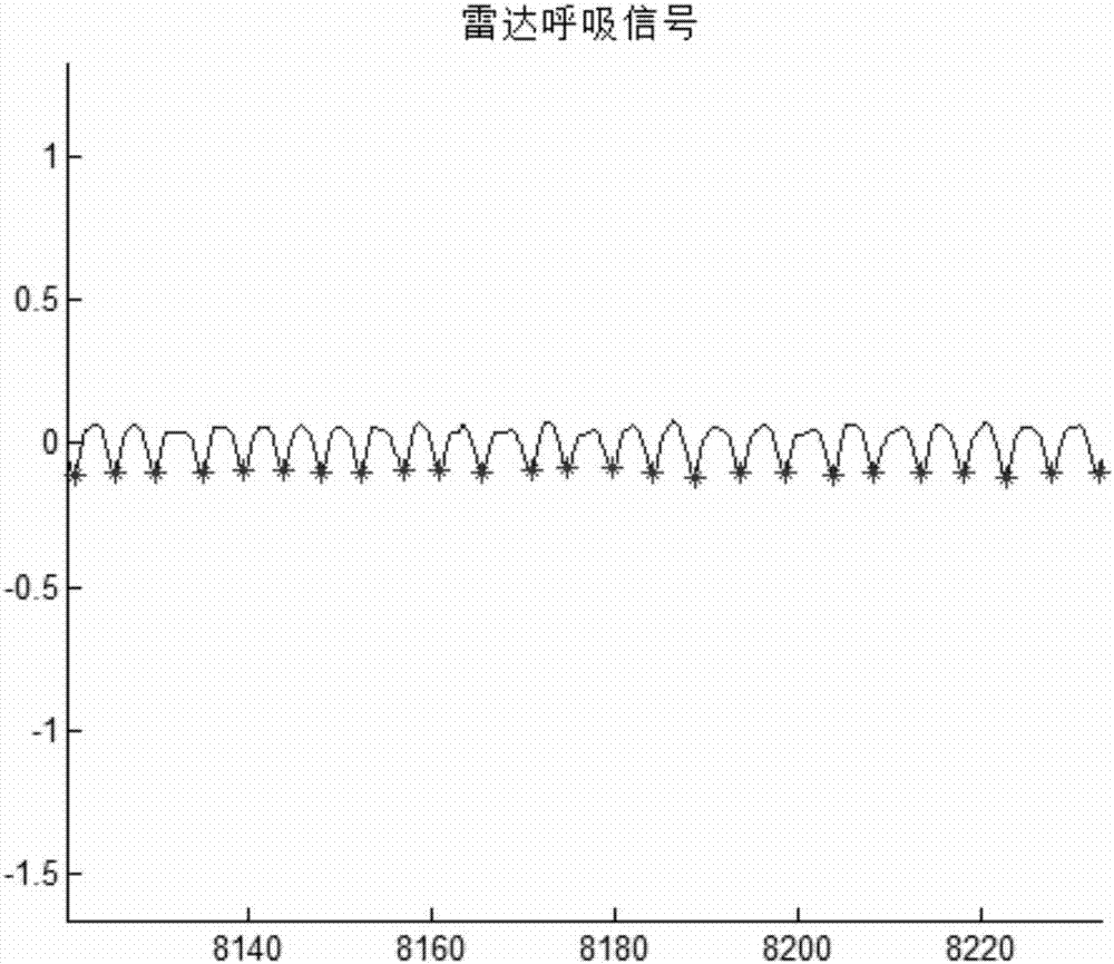 非接触式睡眠分期方法与流程