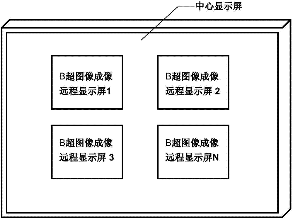 一種基于智能導(dǎo)航探測角度的B超體檢群控系統(tǒng)的制作方法與工藝