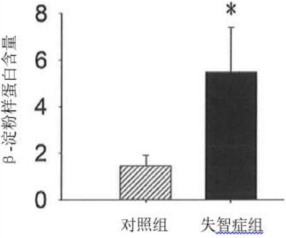 医药组合物用于制备治疗脑神经萎缩相关疾病的用途的制作方法与工艺