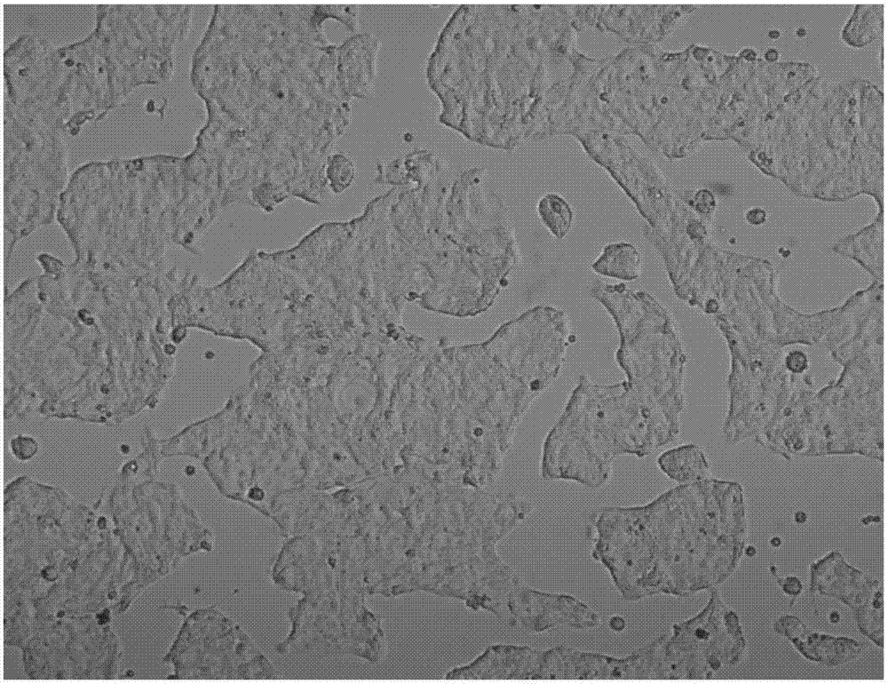 一種肺癌細(xì)胞系及其應(yīng)用的制作方法與工藝