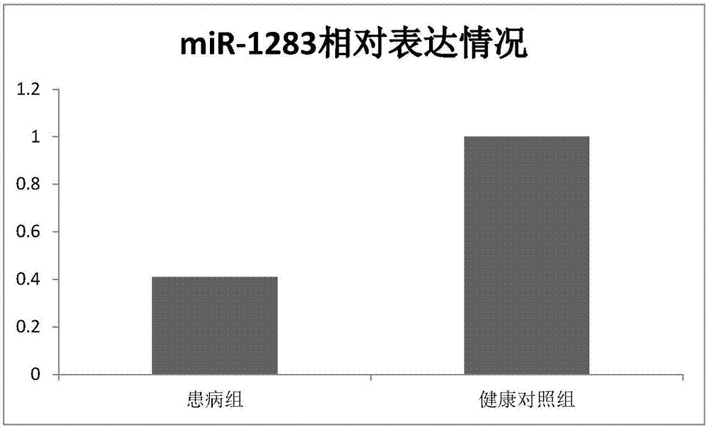 心肌梗死生物標志物miR?1283的制作方法與工藝