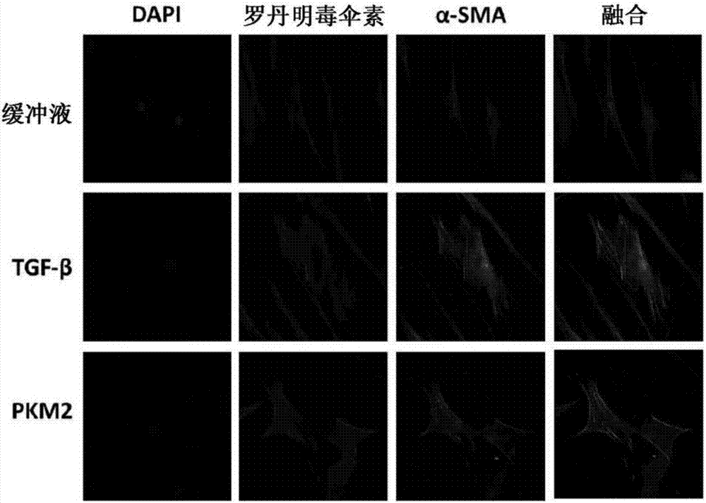 破坏丙酮酸激酶M2和整合素相互作用的分子和其用途的制作方法与工艺