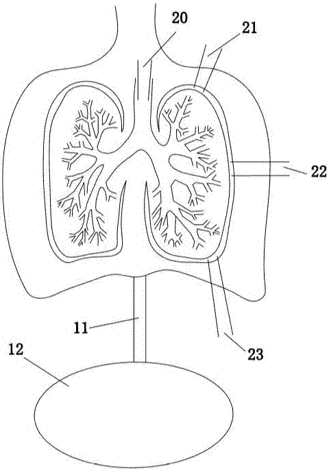 一种模仿胸膜腔生理和病理变化的组合模型教具的制作方法