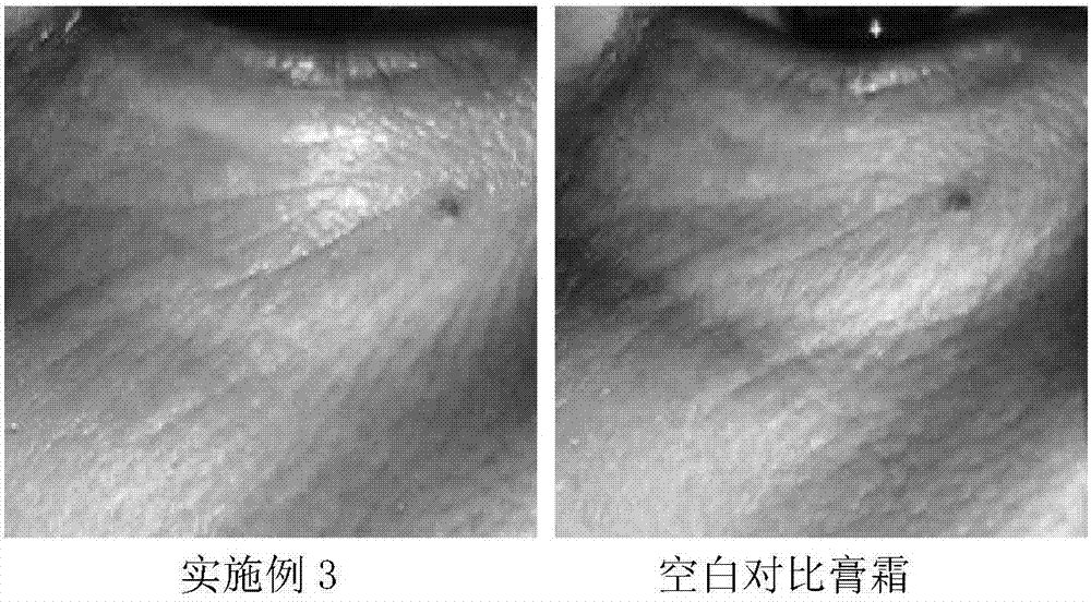 一种含有海绵微针可促进透皮吸收的化妆品组合物的制作方法