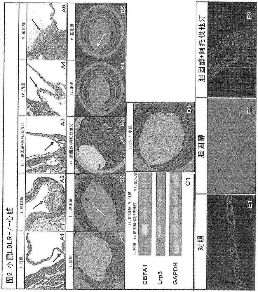 用于抑制天然心脏瓣膜、被支撑的心脏瓣膜或生物假体的狭窄、阻塞或钙化的装置和方法与流程