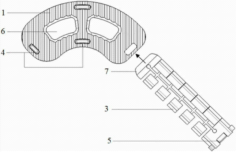 本实用新型涉及用于脊柱椎间融合手术的椎间融合器,尤其是涉及一种楔