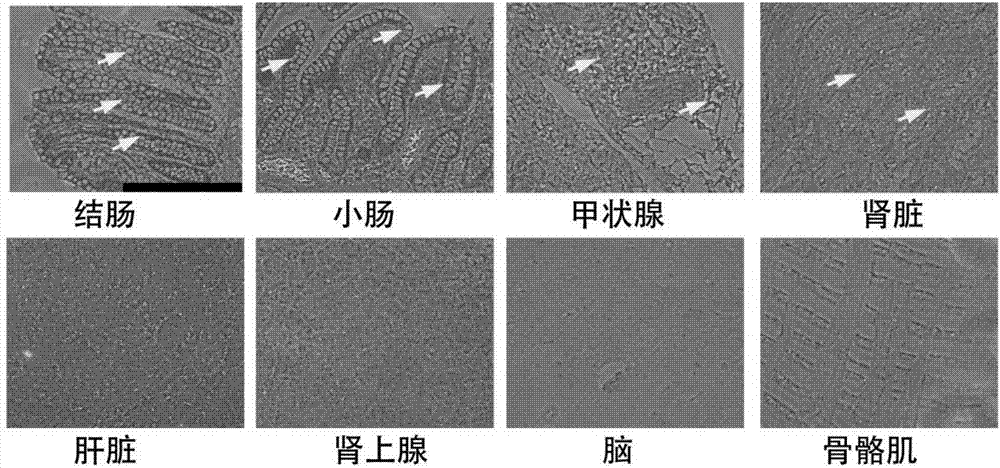 Metrnl蛋白或基因在调节抗菌肽表达中的应用的制作方法