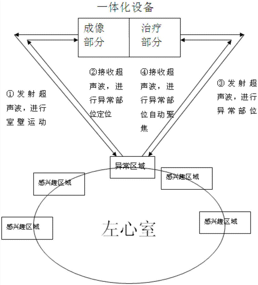 左心室功能异常超声成像治疗一体化设备的制作方法