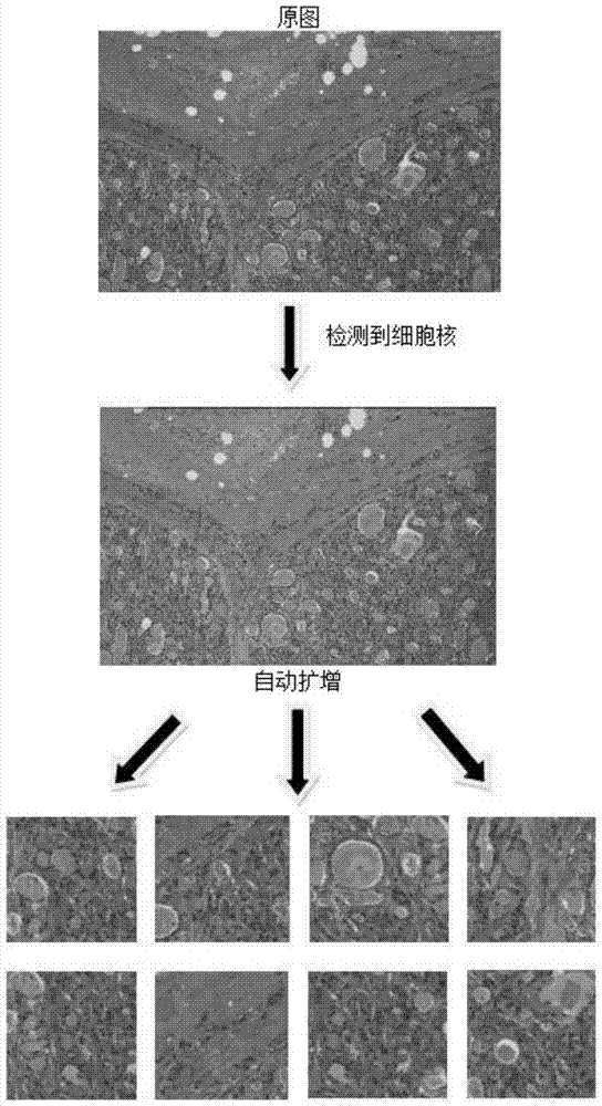 一种甲状腺肿瘤病理组织切片图像分类方法及其装置与流程
