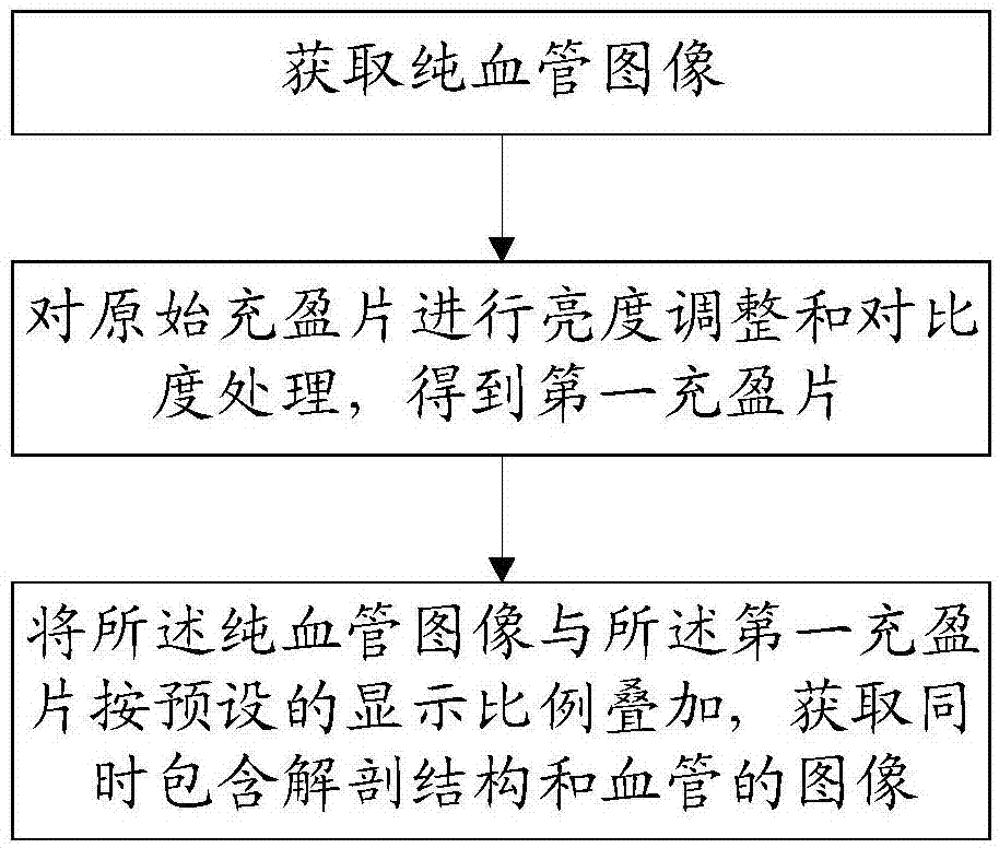 数字减影血管造影方法、计算机存储介质与流程