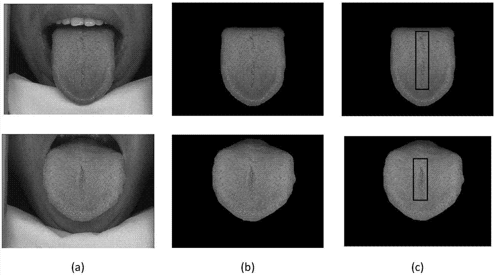 一种基于ssd网络的裂纹舌识别方法与流程