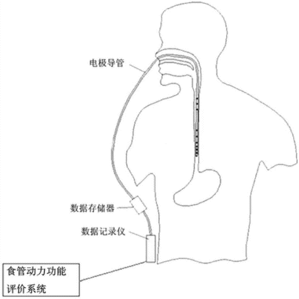 食管动力功能评价系统及方法与流程