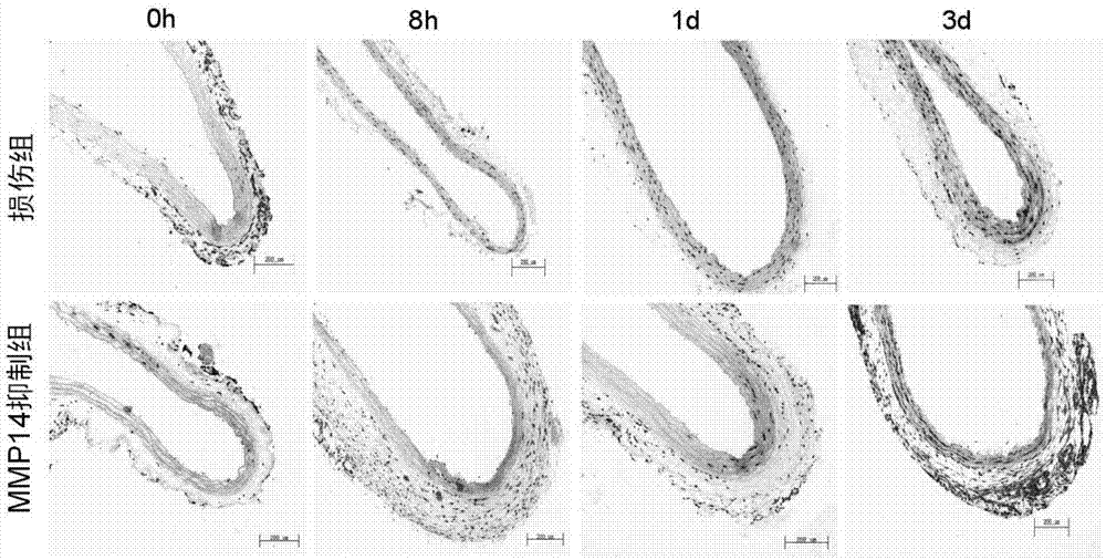 MMP-14抑制剂在制备治疗血管损伤的药物中的应用的制作方法