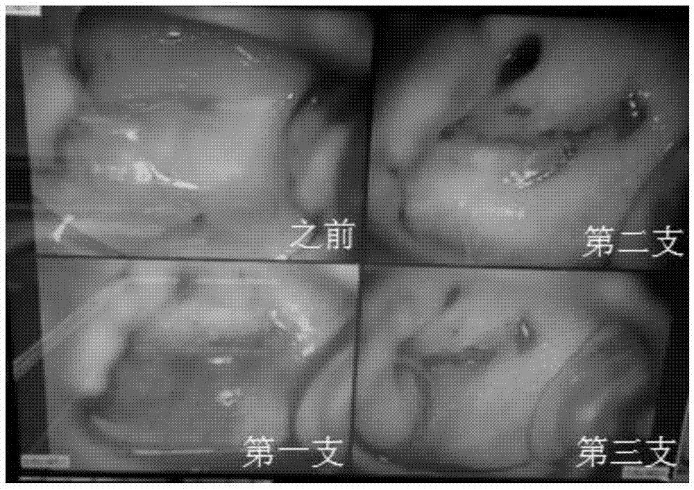 一种治疗皮肤及黏膜疾病的中药复方制剂及其制备方法与流程