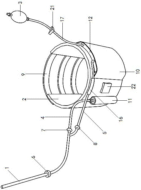 尿失禁控制器的制作方法