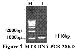 结核分枝杆菌38KD蛋白DNA提取、重组载体构建表达方法与流程