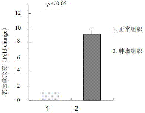 一种胃癌预后分子标志物非编码RNA Lnc-DENR-2及其应用的制作方法