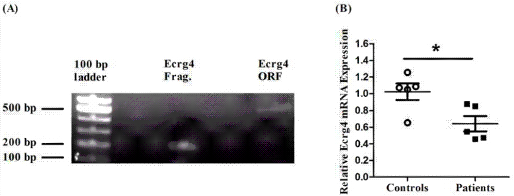 一种含有ECRG4 mRNA的外泌体及其制备方法和应用与流程