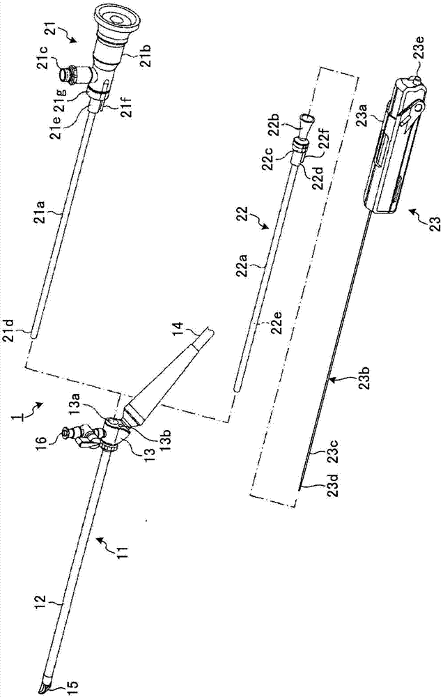 内窥镜的制作方法