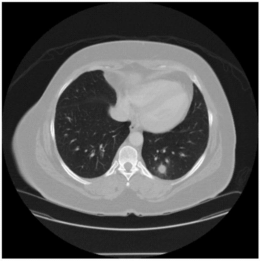 一种基于改进的Faster R-CNN框架的CT图像肺结节检测方法与流程