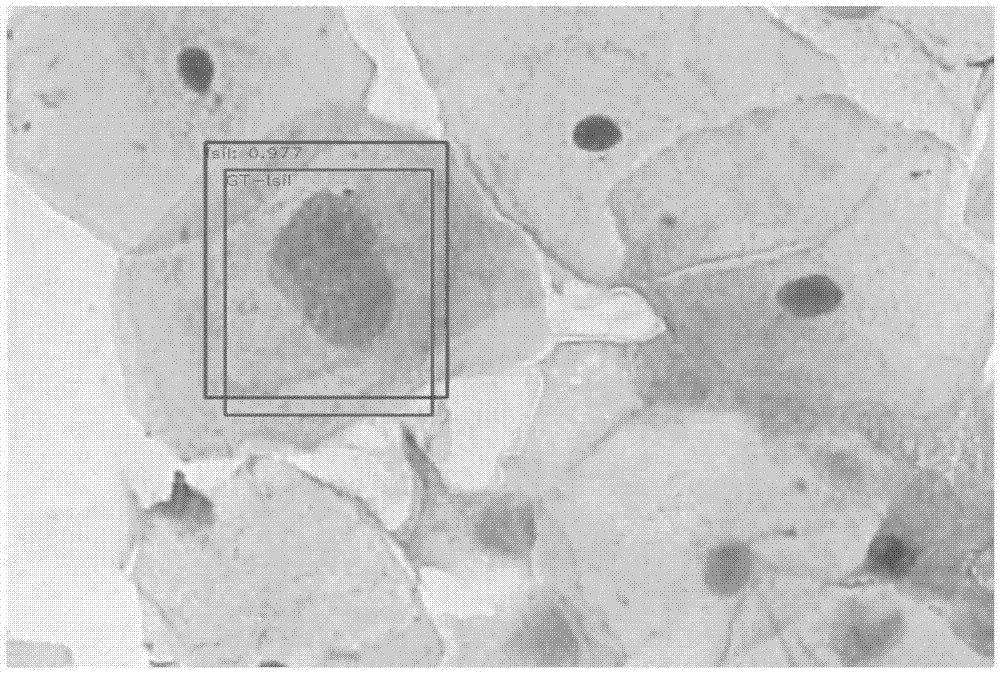 一种宫颈细胞学图像特征的处理方法及其装置与流程
