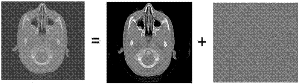 基于DNST的医学CT图像去噪方法与流程