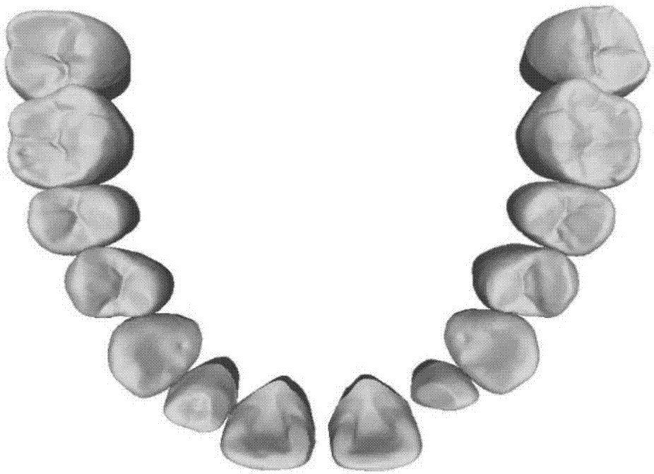 一种基于截面的三维数字化牙齿上下颌关系检测算法的制作方法