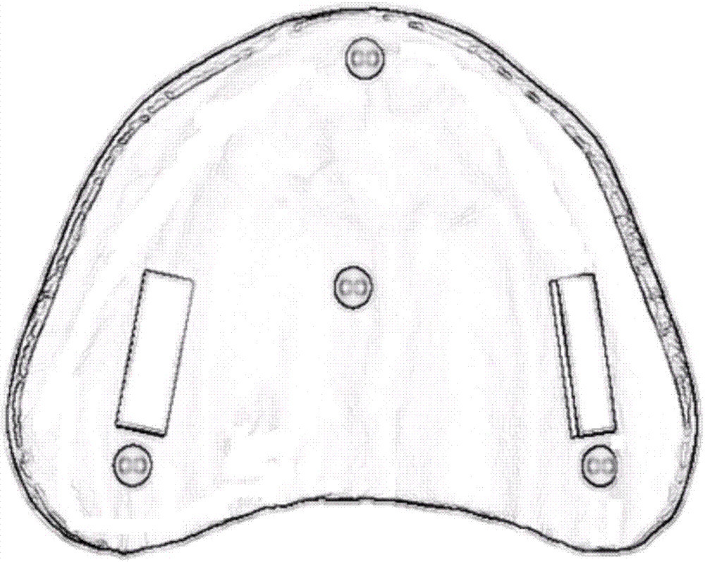 多功能无牙颌无唇翼印模托盘制作方法与流程