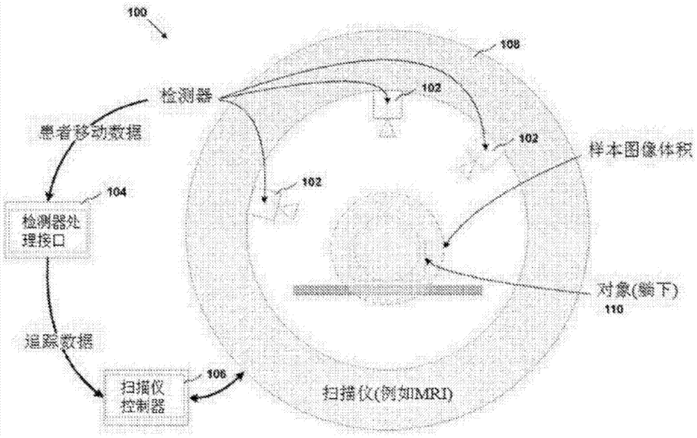 生物医学成像中的实时适应性运动补偿的运动追踪系统的制作方法