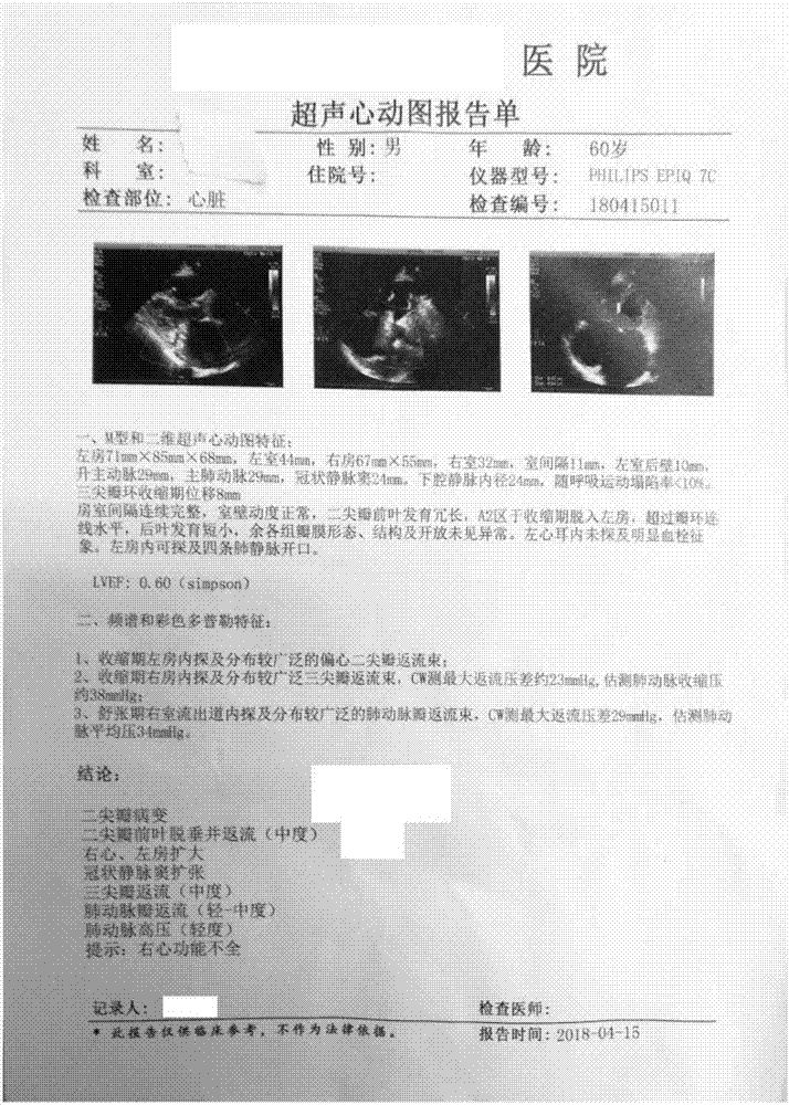 面向心脏病类型和严重程度的智能评估诊断方法及系统与流程