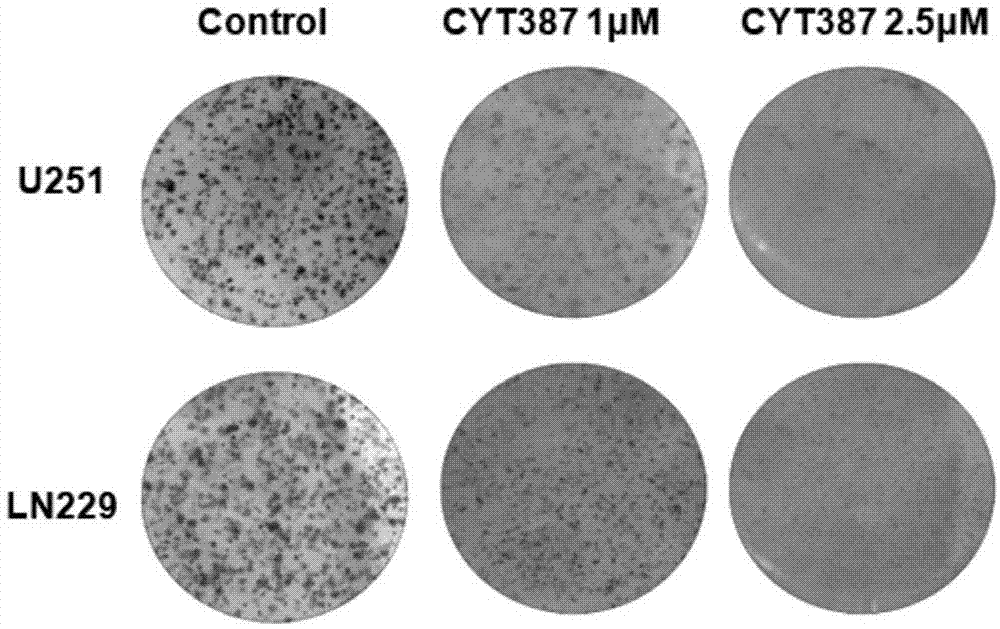 CYT387用于制备治疗神经胶质瘤的药物的应用的制作方法