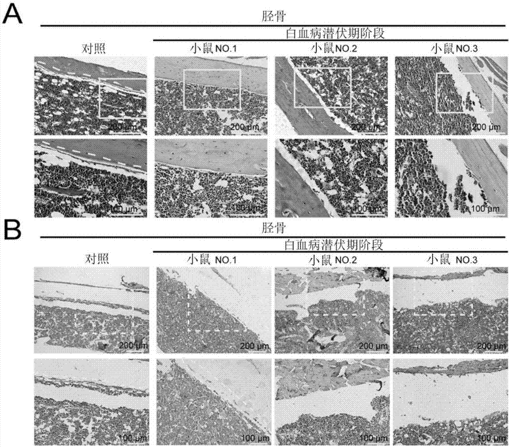 一种重塑骨髓微环境的方法与流程