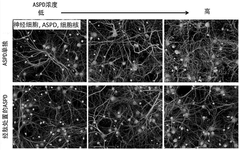 淀粉样蛋白球体（ASPD）结合抑制肽以及评价和筛选方法与流程