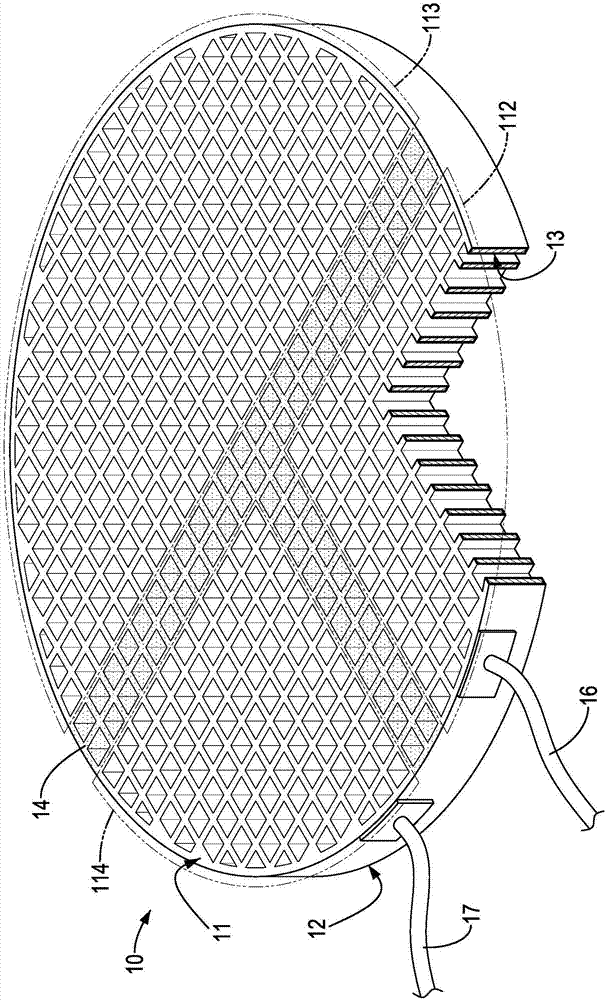 陶瓷加热片结构的制作方法