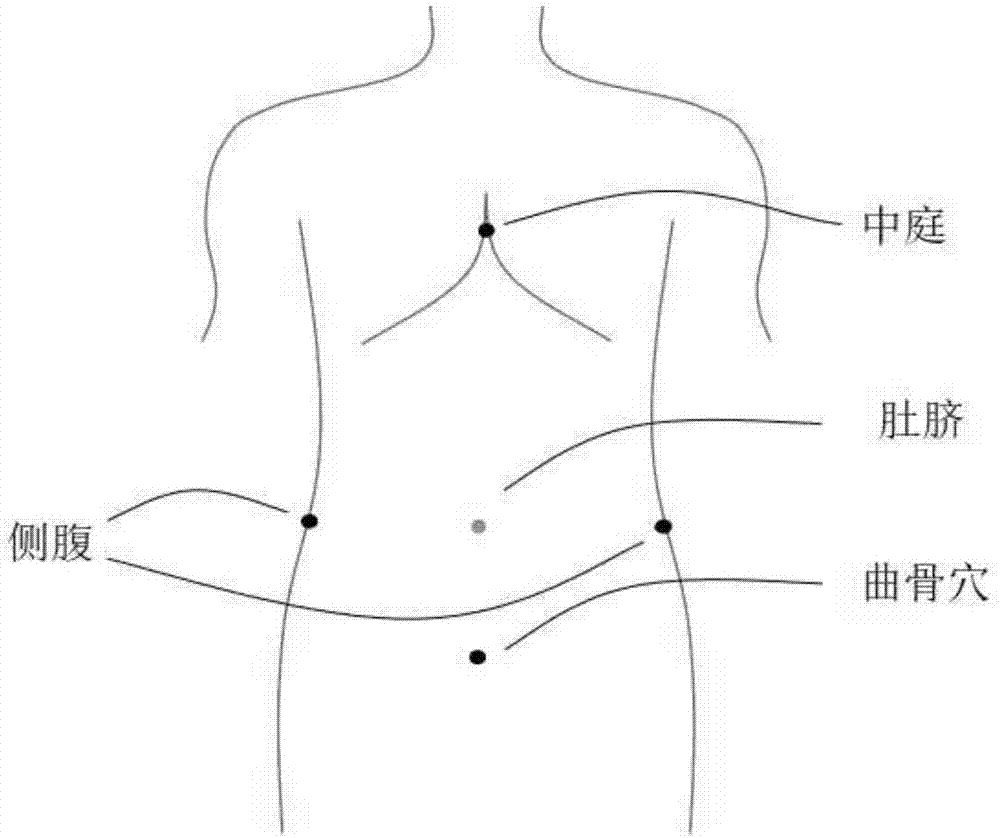 一种腹部穴位的辅助定位方法及装置与流程