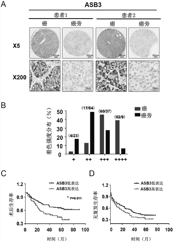 E3泛素连接酶ASB3在制备肝癌治疗药物中的应用的制作方法