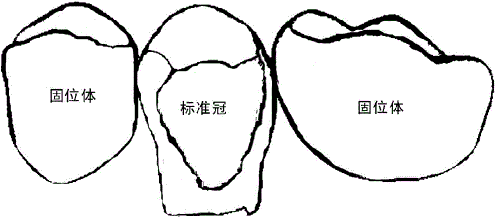 一种全冠桥桥体数字化生成方法与流程