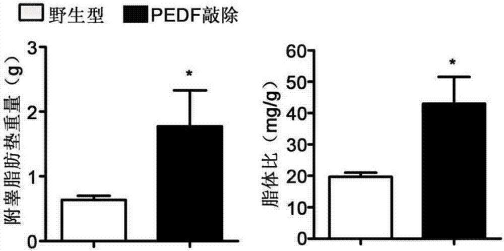 PEDF基因在治疗糖尿病性心肌损伤中的应用的制作方法